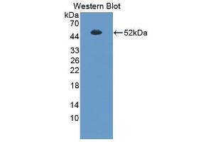 Western blot analysis of the recombinant protein. (SFTPB 抗体  (AA 201-381))