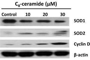 Western Blotting (WB) image for anti-Superoxide Dismutase 1, Soluble (SOD1) (C-Term) antibody (ABIN2854826)
