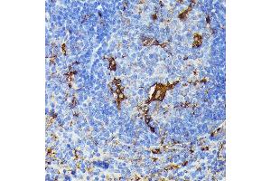 Immunohistochemistry of paraffin-embedded mouse spleen using TI antibody (ABIN6133213, ABIN6149144, ABIN6149145 and ABIN6221696) at dilution of 1:100 (40x lens). (TIAL1 抗体  (AA 266-375))