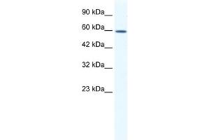 WB Suggested Anti-DDX5 Antibody Titration:  1. (DDX5 抗体  (C-Term))