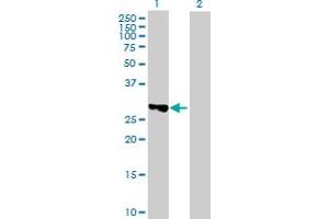 Western Blot analysis of TBC1D7 expression in transfected 293T cell line by TBC1D7 MaxPab polyclonal antibody. (TBC1D7 抗体  (AA 1-293))