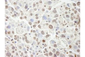 Immunohistochemistry (IHC) image for anti-PHD Finger Protein 6 (PHF6) (AA 125-175) antibody (ABIN7448999) (PHF6 抗体  (AA 125-175))