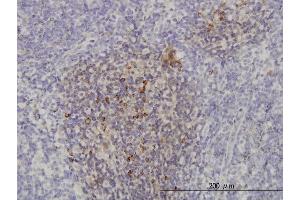 Immunoperoxidase of monoclonal antibody to PIK3CB on formalin-fixed paraffin-embedded human lymph node. (PIK3CB 抗体  (AA 147-256))