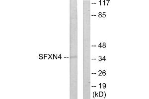 Western blot analysis of extracts from HUVEC cells, using SFXN4 antibody. (Sideroflexin 4 抗体  (N-Term))