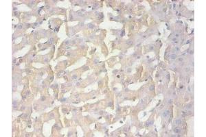 Immunohistochemical of paraffin-embedded human liver tissue using ABIN7165035 at dilution of 1:200 (AMBP 抗体)