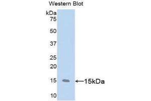 Detection of Recombinant CD59, Rat using Polyclonal Antibody to Cluster of Differentiation 59 (CD59) (CD59 抗体  (AA 23-105))