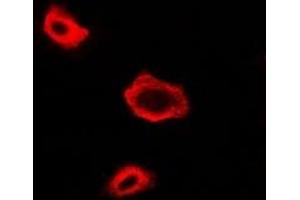Immunofluorescent analysis of NAT13 staining in A549 cells. (NAA50 抗体)