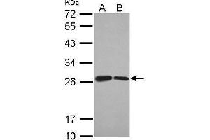 WB Image Sample (30 ug of whole cell lysate) A: Jurkat B: Raji 12% SDS PAGE antibody diluted at 1:1000 (BUD31 抗体)