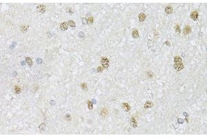 Immunohistochemistry of paraffin-embedded Mouse brain using CMAS Polyclonal Antibody at dilution of 1:150 (40x lens). (CMAS 抗体)