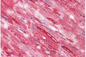 Human Heart: Formalin-Fixed, Paraffin-Embedded (FFPE) (TTYH2 抗体  (N-Term))