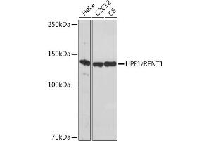 Western blot analysis of extracts of various cell lines, using UPF1/RENT1 Rabbit mAb (ABIN7271226) at 1:1000 dilution. (RENT1/UPF1 抗体)