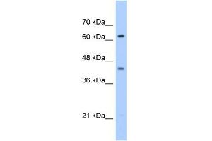 WB Suggested Anti-ZSCAN5D Antibody Titration:  0. (ZSCAN5D 抗体  (Middle Region))