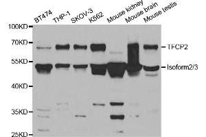 Western blot analysis of extracts of various cell lines, using TFCP2 antibody (ABIN5973236) at 1/1000 dilution.