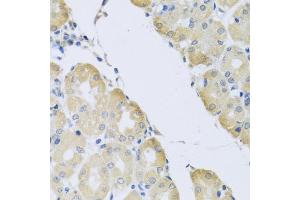 Immunohistochemistry of paraffin-embedded human stomach using C1 antibody (ABIN3016169, ABIN3016170, ABIN3016171 and ABIN6219598) at dilution of 1:100 (40x lens). (ATP2C1 抗体  (AA 400-660))