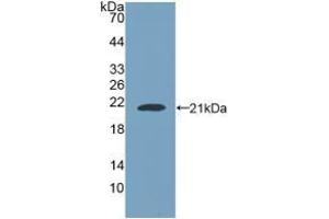 Detection of Recombinant NUP210, Human using Polyclonal Antibody to Nuclear Pore Glycoprotein 210 (gp210) (Nuclear Pore Glycoprotein 210 (AA 1288-1449) 抗体)