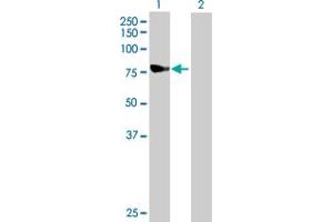 Western Blotting (WB) image for anti-NADH Dehydrogenase (Ubiquinone) Fe-S Protein 1, 75kDa (NADH-Coenzyme Q Reductase) (NDUFS1) (AA 1-727) antibody (ABIN518248)