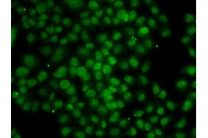 Immunofluorescence analysis of MCF7 cell using ATMIN antibody. (ATM Interactor 抗体)