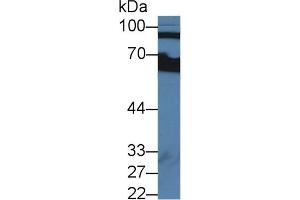 Western blot analysis of Human Serum, using Human CFB Antibody (2 µg/ml) and HRP-conjugated Goat Anti-Rabbit antibody ( (Complement Factor B 抗体  (AA 35-160))