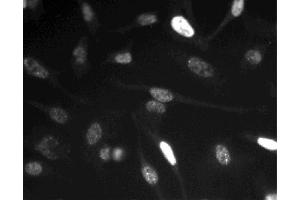 Immunofluorescent staining of HeLa (ATCC CCL-2) cells. (Cyclin E1 抗体)