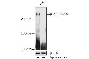 Western blot analysis of extracts of HeLa cells, using Phospho-ATR-T1989 antibody (ABIN7265777) at 1:1000 dilution. (ATR 抗体  (pThr1989))