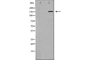 Western blot analysis of Integrin β1 expression in Jurkat cells. (ITGB1 抗体  (C-Term))