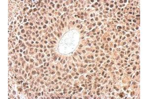 IHC-P Image Cyclophilin E antibody detects PPIE protein at nucleus on HeLa xenograft by immunohistochemical analysis. (PPIE 抗体)
