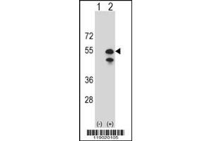Western blot analysis of CPN1 using rabbit polyclonal CPN1 Antibody using 293 cell lysates (2 ug/lane) either nontransfected (Lane 1) or transiently transfected (Lane 2) with the CPN1 gene. (CPN1 抗体  (N-Term))