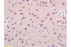 Formalin-fixed and paraffin embedded rat brain labeled with Anti-GRP75 Polyclonal Antibody, Unconjugated (ABIN686992) at 1:200 followed by conjugation to the secondary antibody and DAB staining. (HSPA9 抗体  (AA 561-679))