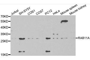 Western blot analysis of extracts of various cell lines, using RAB11A antibody. (RAB11A 抗体  (AA 1-216))