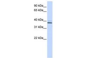 Image no. 1 for anti-ERGIC and Golgi 2 (ERGIC2) (C-Term) antibody (ABIN6740585) (ERGIC2 抗体  (C-Term))