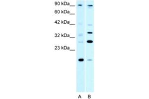 Western Blotting (WB) image for anti-Poly (ADP-Ribose) Polymerase Family, Member 11 (PARP11) antibody (ABIN2460805) (PARP11 抗体)