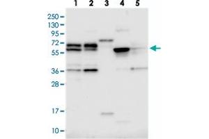 Western blot analysis of Lane 1: RT-4, Lane 2: U-251 MG, Lane 3: Human Plasma, Lane 4: Liver, Lane 5: Tonsil with C15orf52 polyclonal antibody  at 1:250-1:500 dilution. (C15ORF52 抗体)