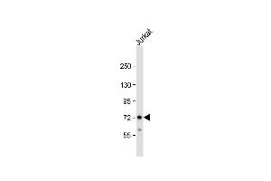 Anti-ZFP36 Antibody (Center) at 1:1000 dilution + Jurkat whole cell lysate Lysates/proteins at 20 μg per lane. (ZFP36 抗体  (AA 119-148))