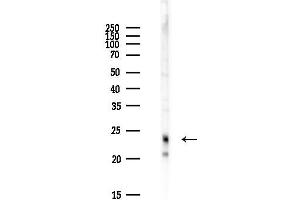 Western blot analysis of lysates from Hela cells(heat-shock,45 min treatment), using CFAP20 Antibody at 1/1000 dilution.