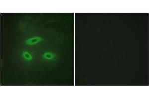 Immunofluorescence analysis of HeLa cells, using NKTR Antibody. (NKTR 抗体  (AA 784-833))