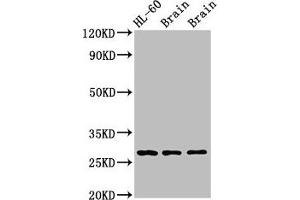 Western Blot Positive WB detected in: Rat brain tissue, Mouse brain tissue All lanes: EMX2 antibody at 2.