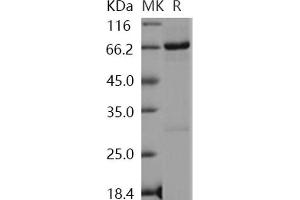 Western Blotting (WB) image for Nemo-Like Kinase (NLK) (Active) protein (GST tag,His tag) (ABIN7317069) (Nemo-Like Kinase Protein (NLK) (GST tag,His tag))