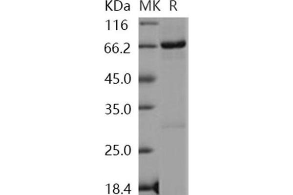 Nemo-Like Kinase Protein (NLK) (GST tag,His tag)