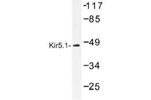 Image no. 1 for anti-Potassium Inwardly-Rectifying Channel, Subfamily J, Member 16 (KCNJ16) antibody (ABIN317797)
