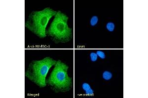CTAG1B 抗体  (Internal Region)