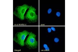 (ABIN570720) Immunofluorescence analysis of paraformaldehyde fixed A549 cells, permeabilized with 0. (CTAG1B 抗体  (Internal Region))