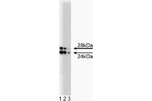 Western blot analysis of COMT on a rat pituitary lysate. (COMT 抗体  (AA 26-141))