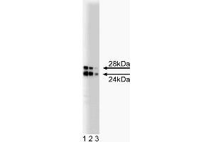 Western blot analysis of COMT on a rat pituitary lysate. (COMT 抗体  (AA 26-141))