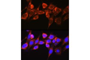 Immunofluorescence analysis of NIH-3T3 cells using Raf1 Rabbit pAb (ABIN3020712, ABIN3020713, ABIN3020714 and ABIN6213686) at dilution of 1:100 (40x lens). (RAF1 抗体  (AA 190-350))