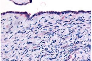 Human Surface Epithelium (formalin-fixed, paraffin-embedded) stained with THRA antibody ABIN213505 at 10 ug/ml followed by biotinylated goat anti-rabbit IgG secondary antibody ABIN481713, alkaline phosphatase-streptavidin and chromogen. (THRA 抗体  (Ligand Binding Domain))