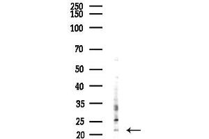anti-Mitochondrial Ribosomal Protein S17 (MRPS17) (Internal Region) antibody