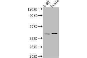 Western Blot Positive WB detected in: U-87 whole cell lysate, Rat Brain whole cell lysate All lanes: NGF antibody at 1:1000 Secondary Goat polyclonal to rabbit IgG at 1/50000 dilution Predicted band size: 27 kDa Observed band size: 39 kDa (Recombinant Nerve Growth Factor 抗体)