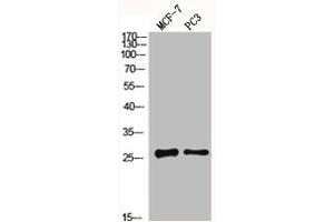 Western Blot analysis of MCF7 PC3 cells using MGMT Polyclonal Antibody (MGMT 抗体  (N-Term))