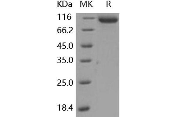 ASAH2 Protein (His tag)