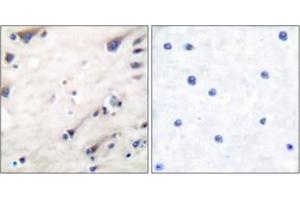Immunohistochemistry analysis of paraffin-embedded human brain tissue, using KSR (Ab-392) Antibody. (KSR1 抗体  (AA 358-407))